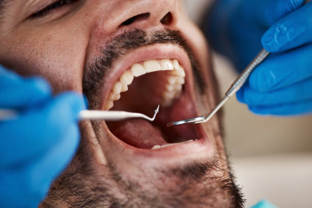 Best Emergency Dentist Near Me  in Park Forest, IL